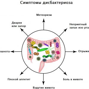 Что такое дисбактериоз кишечника